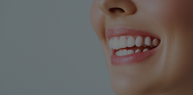 Teeth Whitening - Dental Clinic Chelsea London