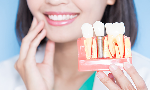 Cheap Dental Implants in London