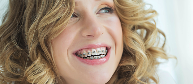 Dental Braces Cost Chelsea London