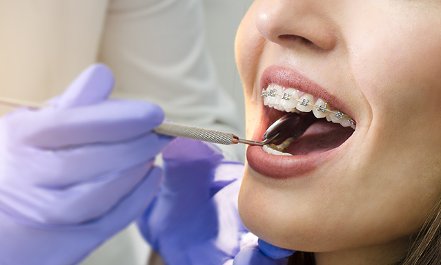 Orthodontics treatment Chelsea London