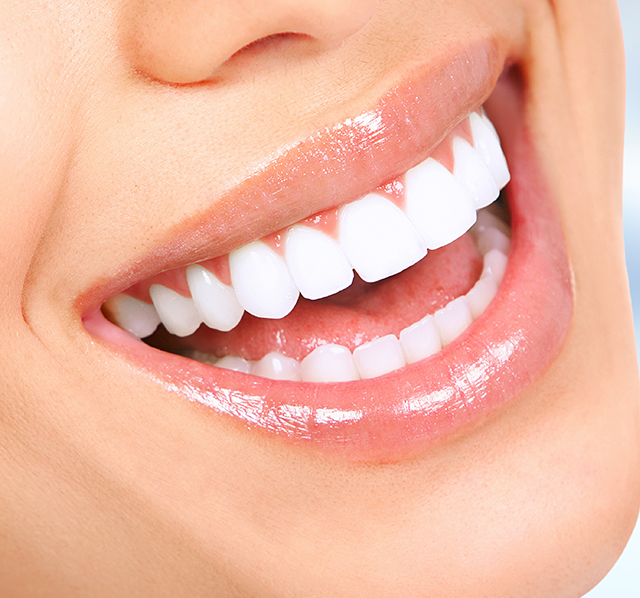 Smile Transformation- Why Choose Dental Clinic Chelsea