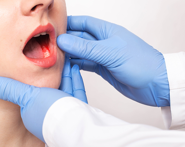 Tooth Abscess Treatment Chelsea